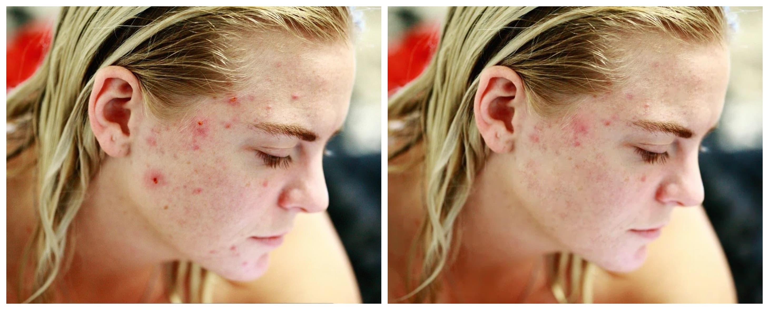 Photoshop Clone Stamp Tool Before and After Comparison